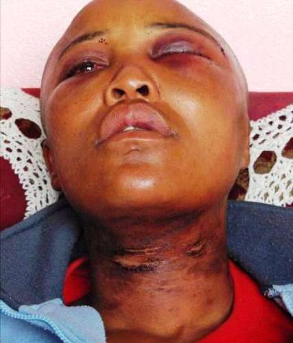Woman Raped To Cure Her Homosexuality. (It Didn’t Work)