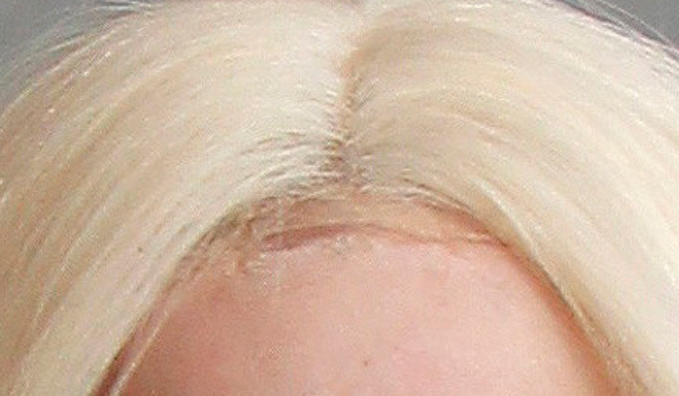 Lady Gaga going bald receding gay blog, gay news, receding hair line