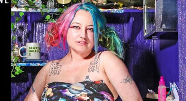 Comedian Amputee Wants You To Play ‘Guess The Celebrity’ With Her Leg Stump