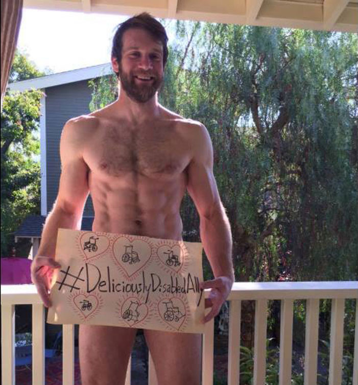 Deliciously Disabled, disabilities, picture, sexy, campaign