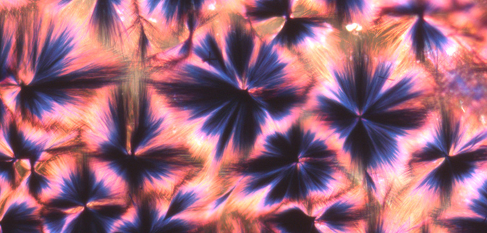 3 Recent HIV Breakthroughs Could Change Things Forever