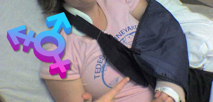 Is “Trans Broken Arm Syndrome” Actually A Real Thing?