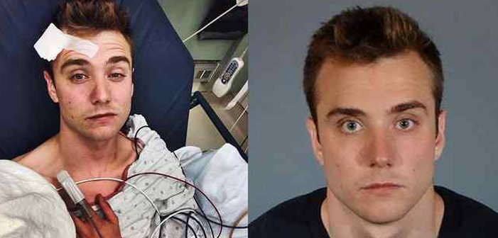 O Youtuber Gay Calum McSwiggan Se Declarou Culpado Pelo Crime de Vandalismo Após Suposta Falsa Comunicação de Ataque Homofóbico