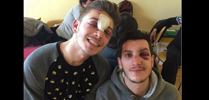 After a Brutal Homophobic Assault in Milan, One of the Victims Speaks