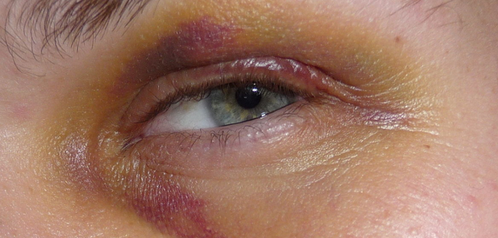 Columbus and Nashville Have an Anti-Gay Hate Crime Problem