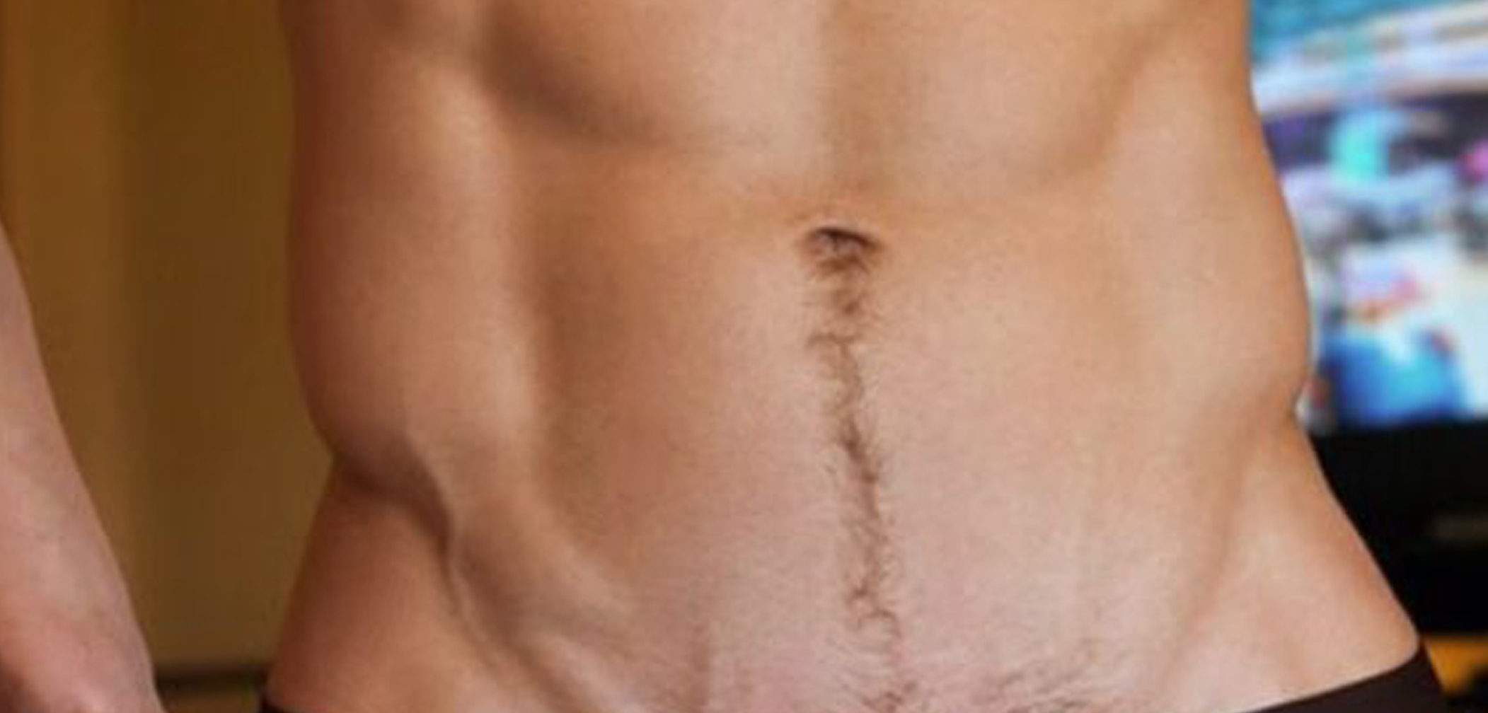 Adivina Que 4 Modelos Mostraron Recientemente los Pelos en Instagram (Fotos)