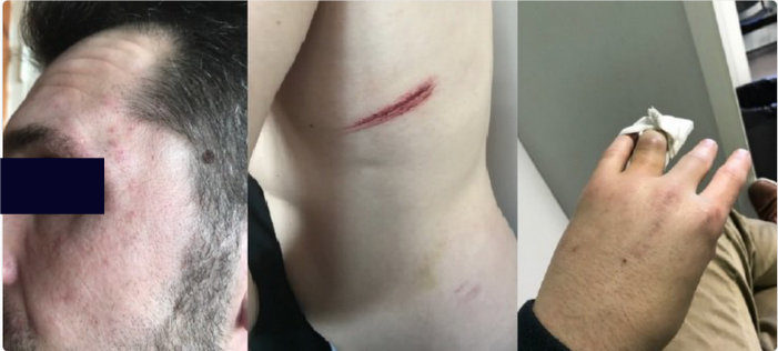L’association Mousse porte plainte après une agression homophobe à Libourne