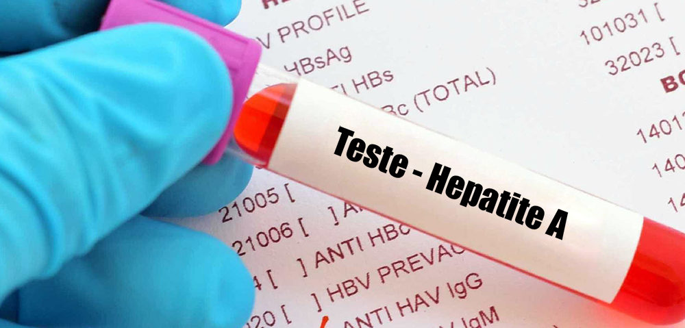 Paulistanos vivem surto de hepatite A com mais de 80% dos casos entre homens