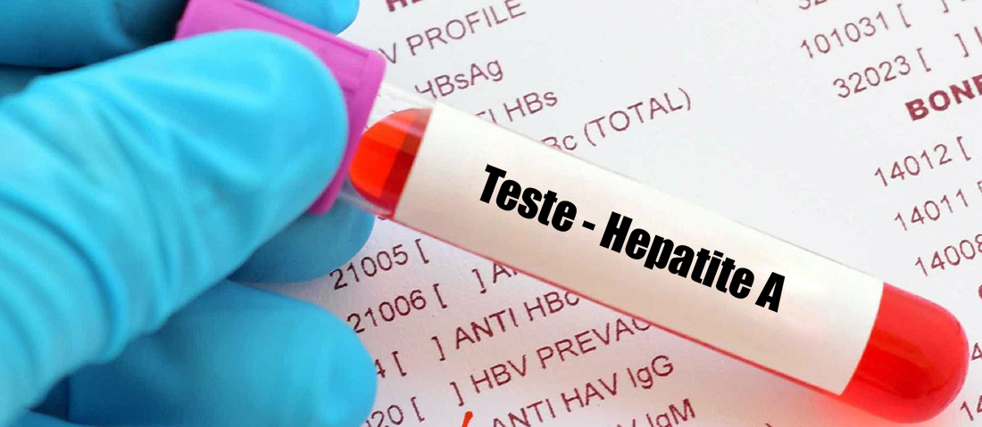 Paulistanos vivem surto de hepatite A com mais de 80% dos casos entre homens