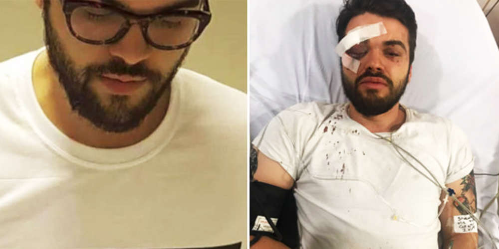 Atleta argentino é agredido por “comportamento gay” e pode ficar cego