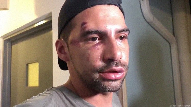 miami gay bashing rene