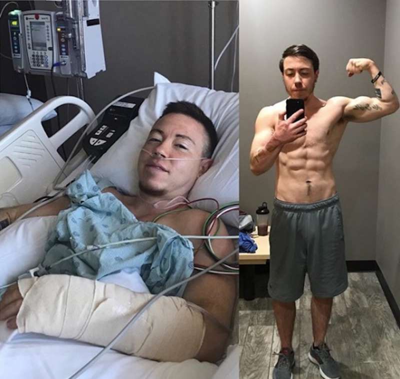 phalloplasty 01, Cody Harman 01