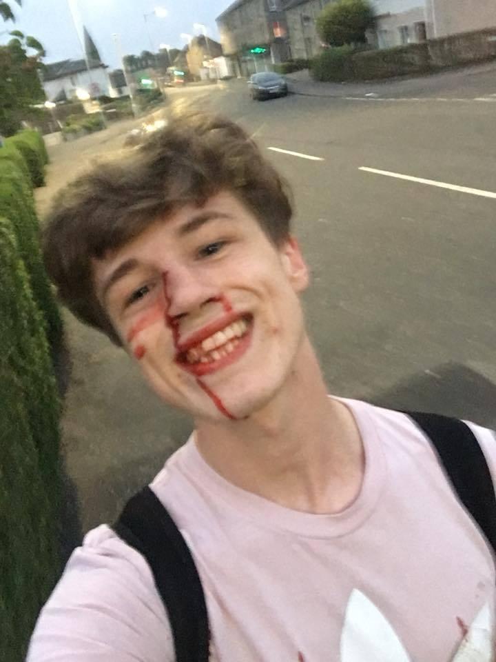 blair wilson gay bashing selfie