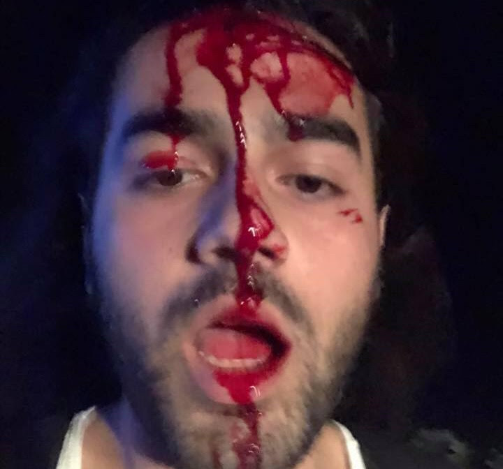 armenian lynch mob shurnukh robert