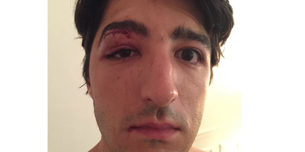 Agression homophobe à Paris: deux suspects arrêtés et placés en garde à vue