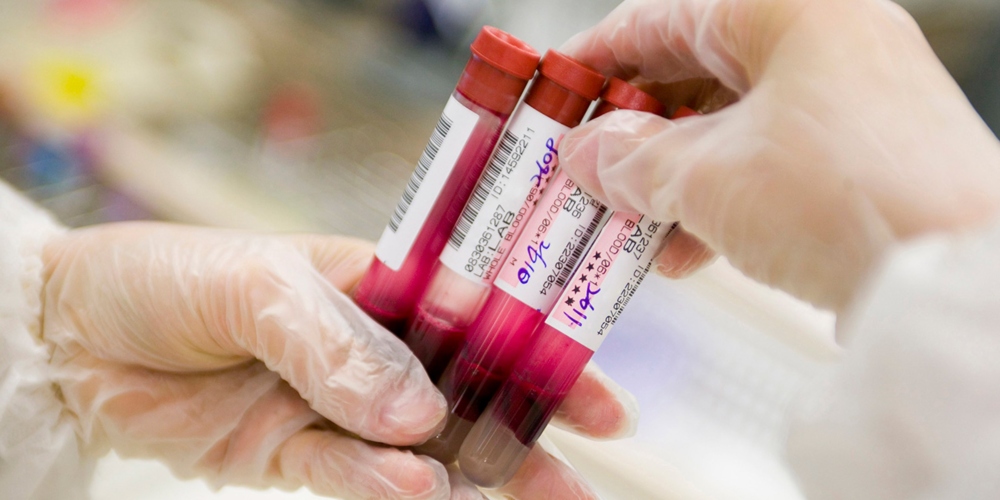 IAPAC lança pesquisa sobre vida de pessoas que vivem com HIV/Adis