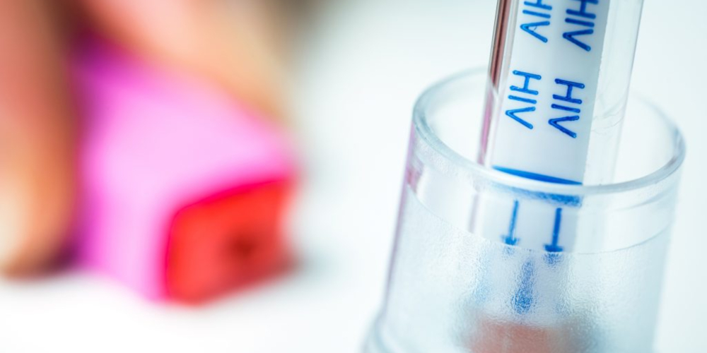 Autoteste de HIV chega ao SUS e contamos como conseguir