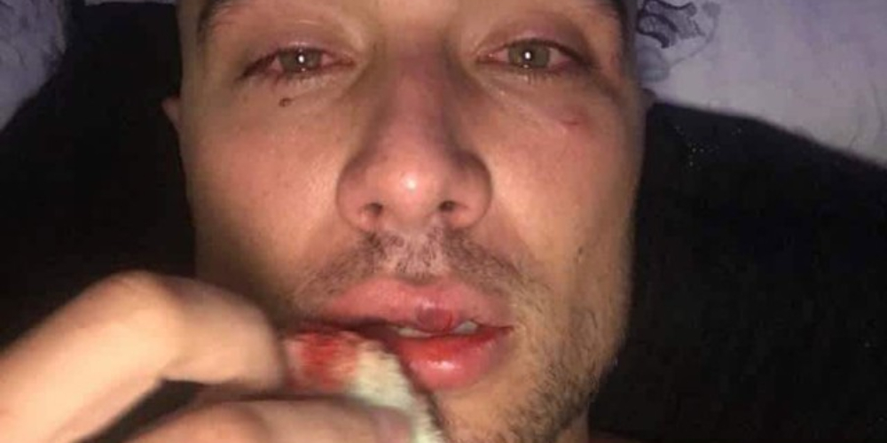 Digital influencer gay é espancado por policiais durante carnaval