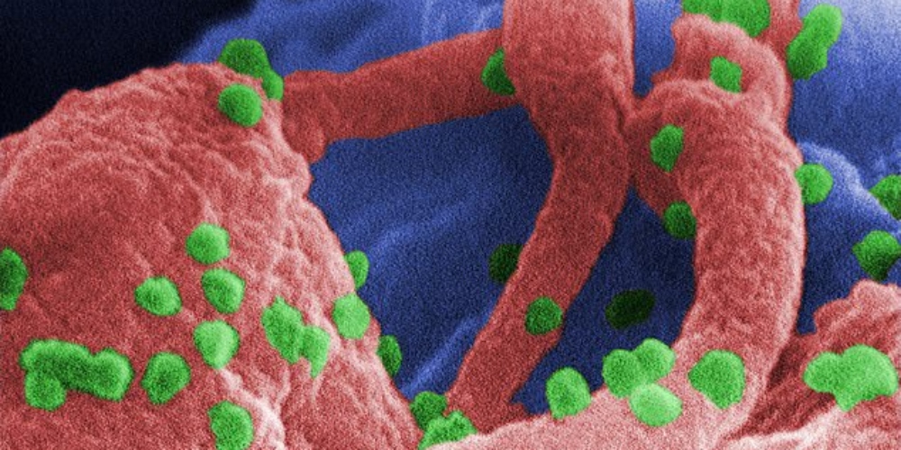 Pesquisadores eliminam pela primeira vez HIV do genoma de animais vivos