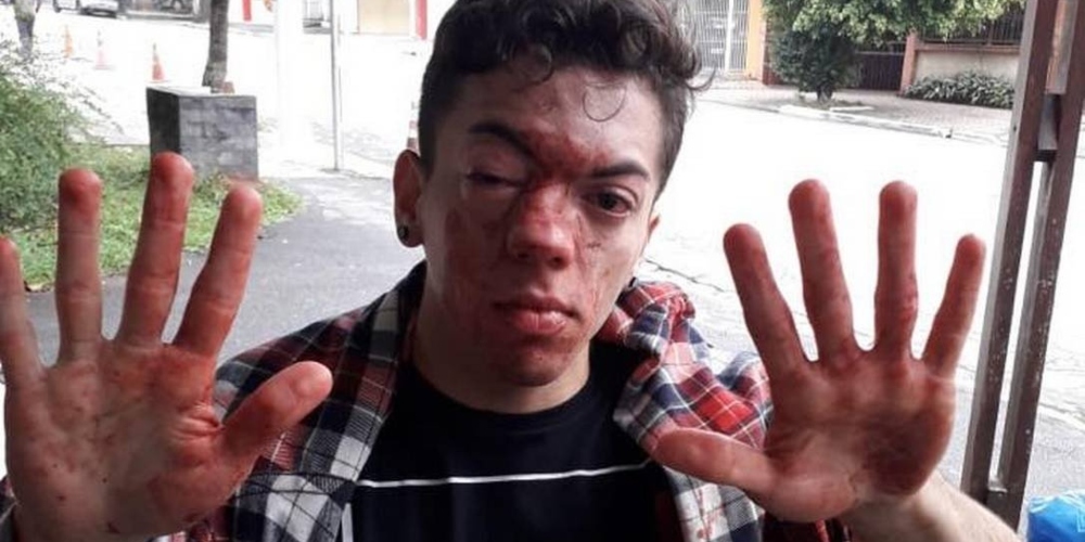 Jovem agredido é obrigado a sair do armário após ser espancado por motorista de ônibus