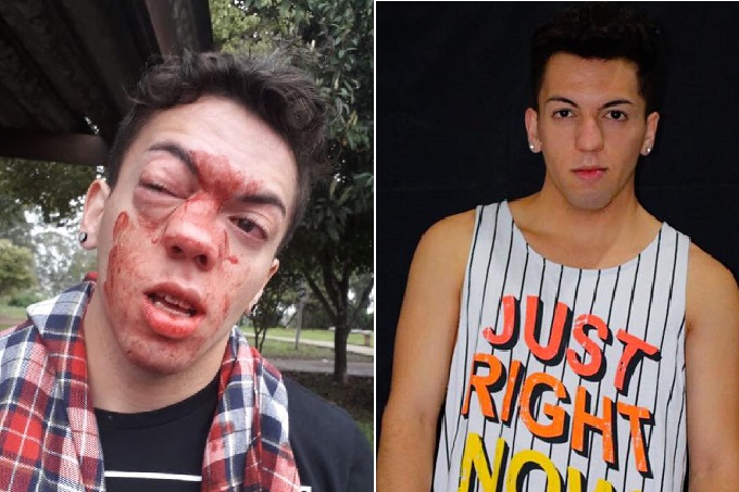 Jovem agredido