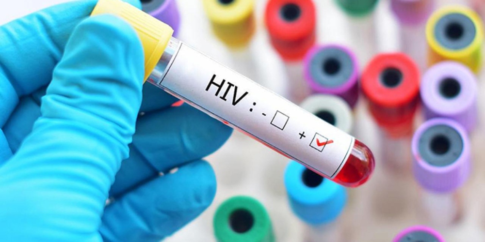 Novo tipo de vírus HIV é descoberto pela primeira vez em 20 anos