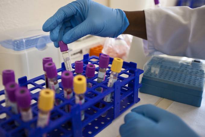 Novo tipo de vírus HIV é descoberto