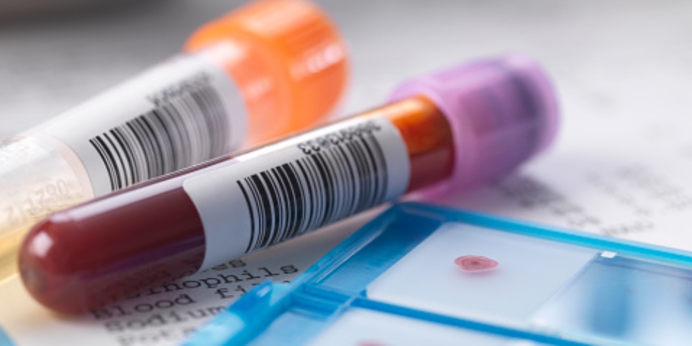 Estudo revela estigma e discriminação que impactam pessoas vivendo com HIV e AIDS no Brasil